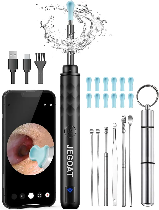 Otoscopio con cámara para tus oídos